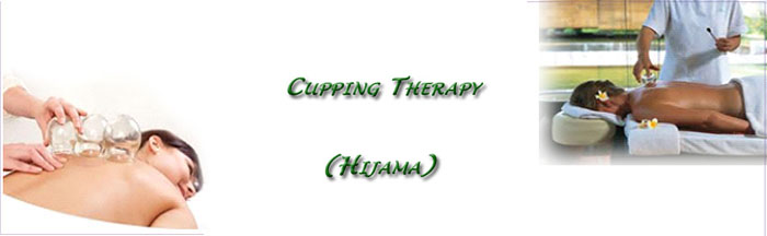 cupping